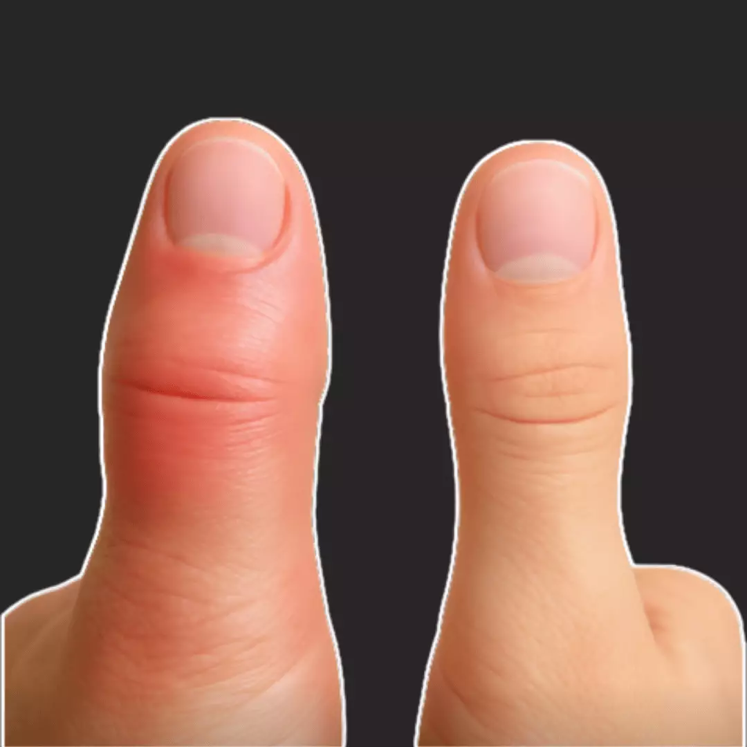 Article thumbnail image